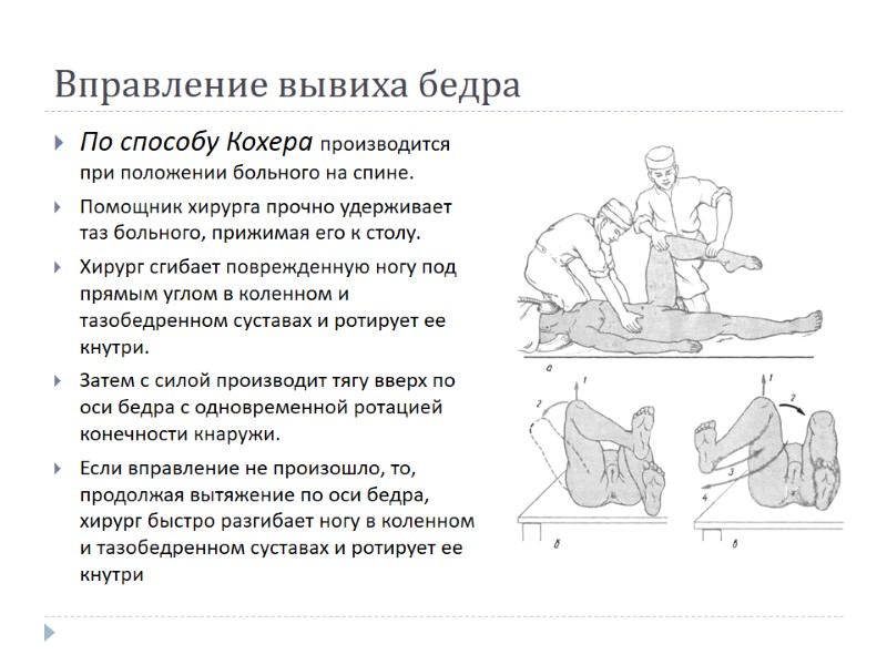 Вправление вывиха бедра По способу Кохера производится при положении больного на спине.  Помощник